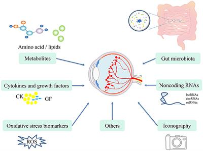 Novel Potential Biomarkers for Retinopathy of Prematurity